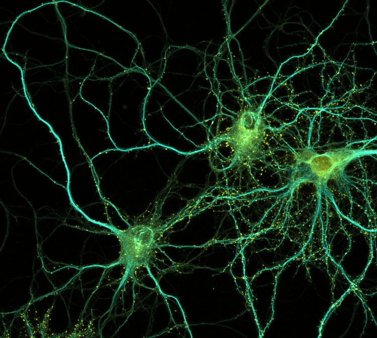 Neurons in culture DIV14 MAP2 PSD95 6.09.2017